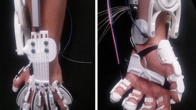 Dank einer neuartigen Exoskelett-Hand können Menschen, die eine gelähmte Hand haben, wieder ihre Hand bewegen. mz im Interview.